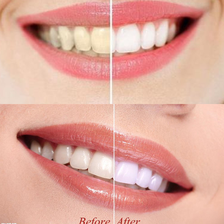 Бамбуковый уголь для зубов, ст – обзор и цена Teeth Whitening Powder