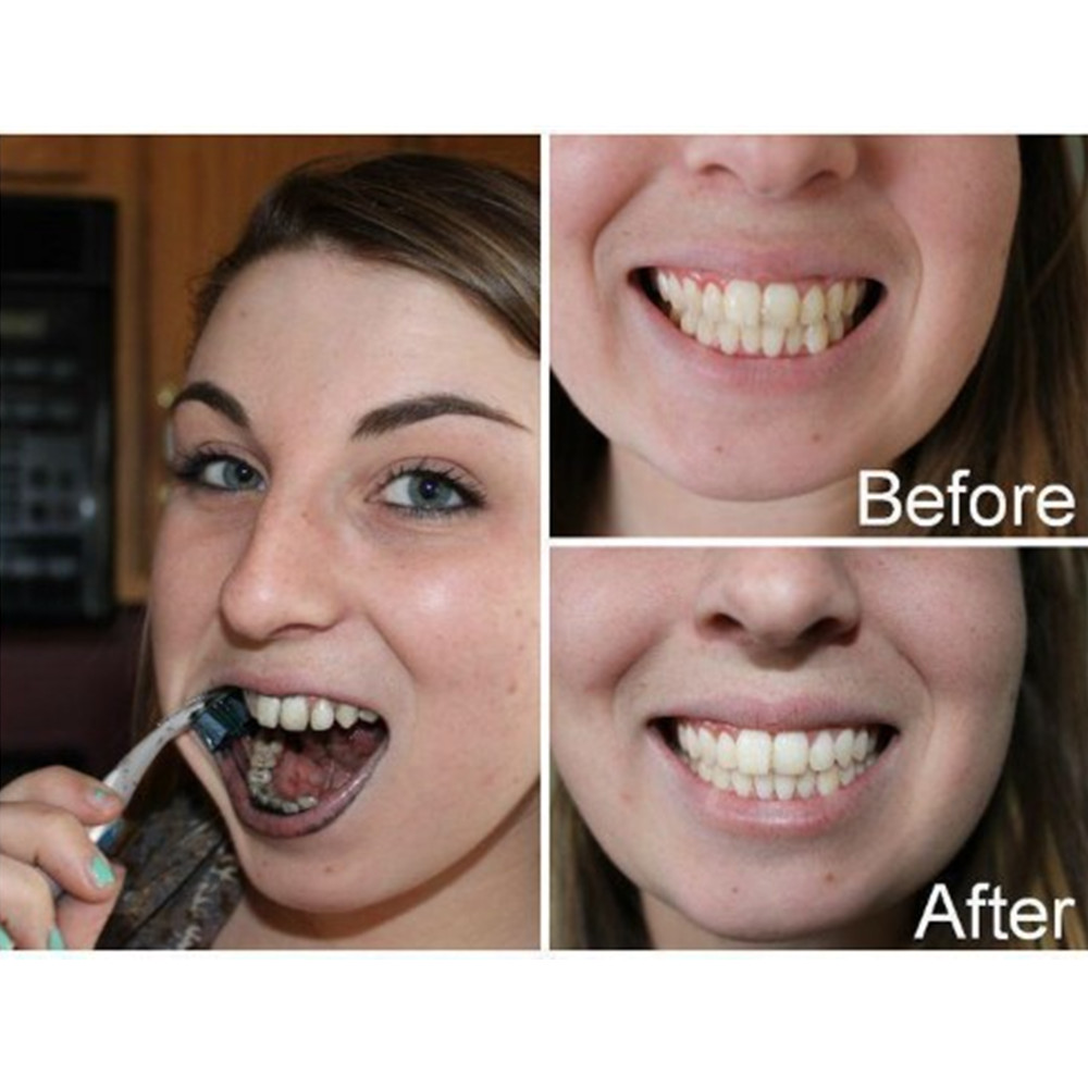 Бамбуковый уголь для зубов, ст – обзор и цена Teeth Whitening Powder