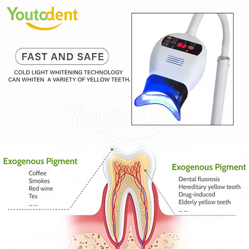 Профессиональная стоматологиче – обзор и цена Teeth Whitening (Bleaching)