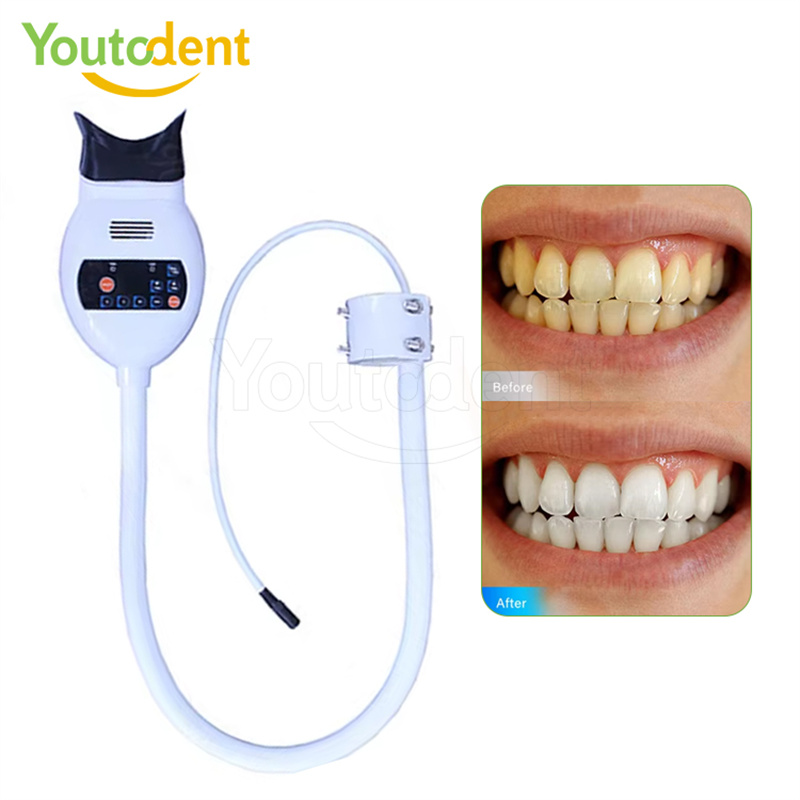 Профессиональная стоматологиче – обзор и цена Teeth Whitening (Bleaching)