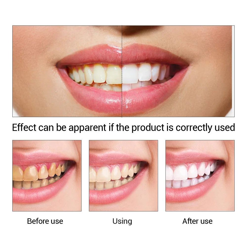 FTEENPLY отбеливание зубов быс – обзор и цена Teeth Whitening Powder