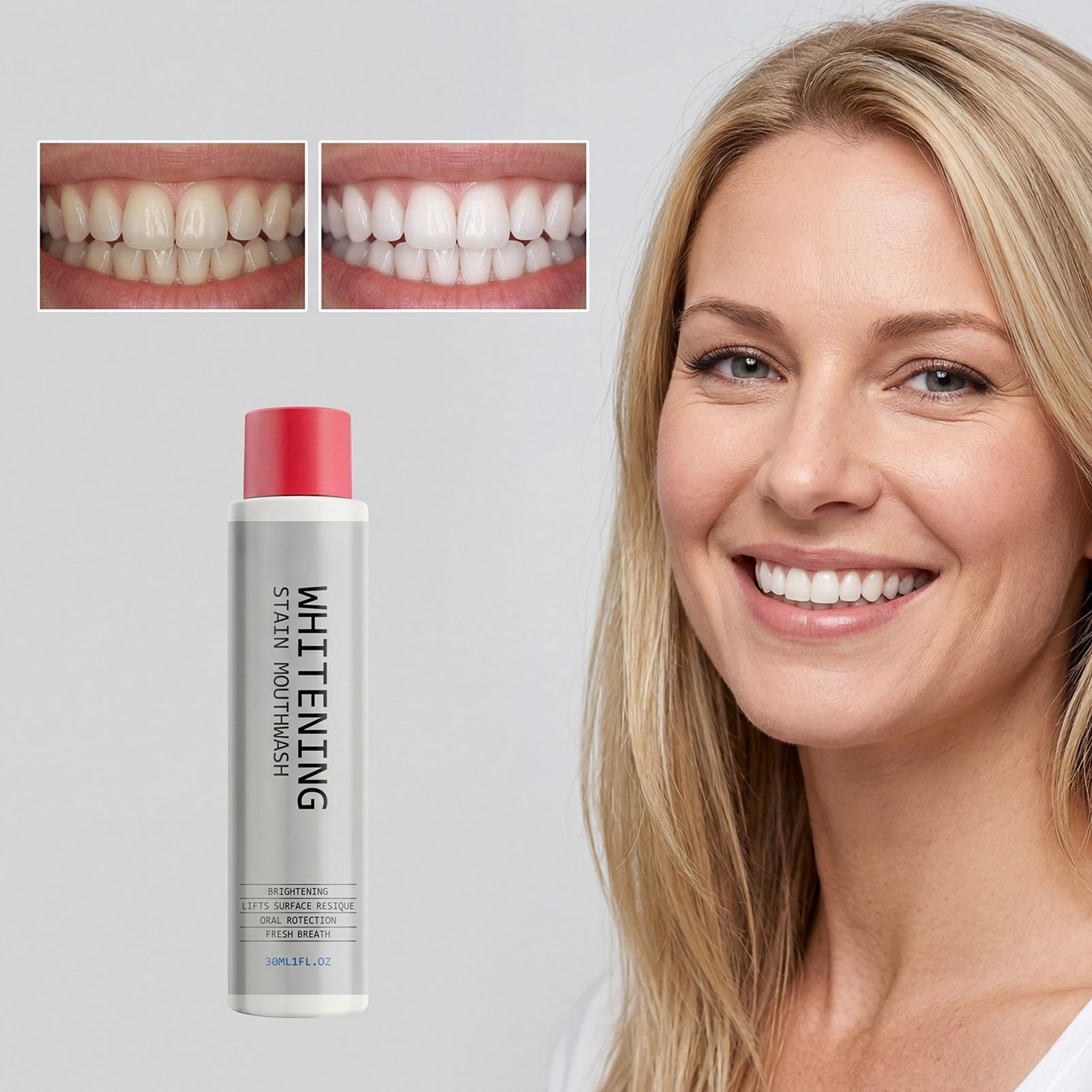 30 мл отбеливающего ополаскива – обзор и цена Whitening Mouthwash