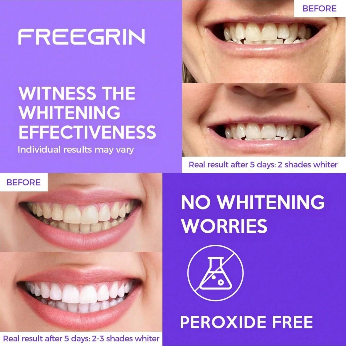 Роскошные отбеливающие наклейк – обзор и цена Teeth Whitening Paste